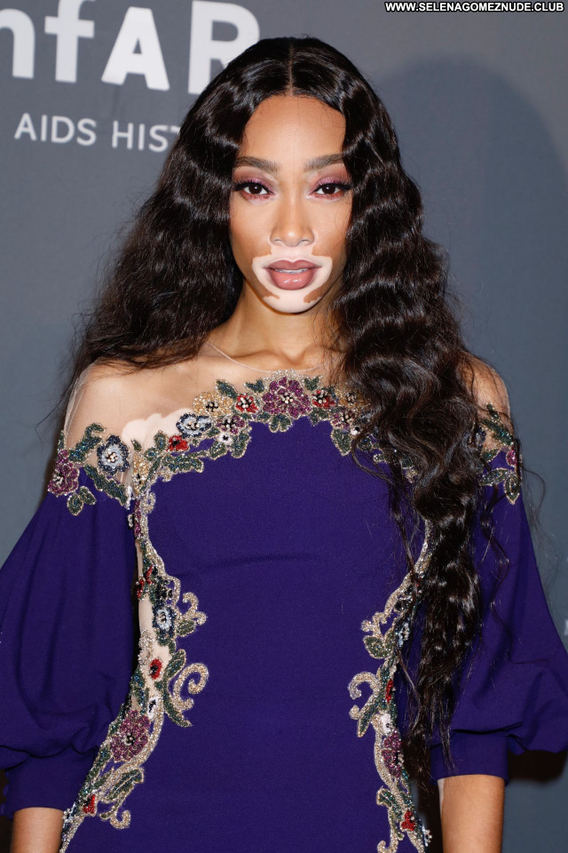 Winnie Harlow No Source Celebrity Beautiful Babe Sexy Posing Hot