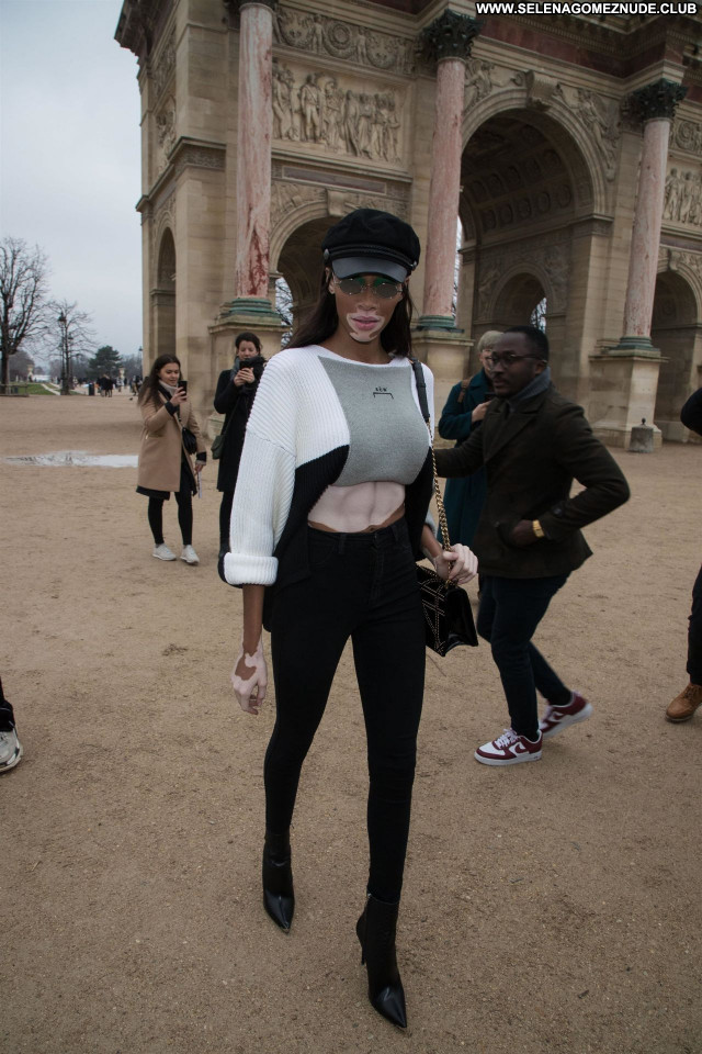 Winnie Harlow No Source Babe Celebrity Sexy Posing Hot Beautiful