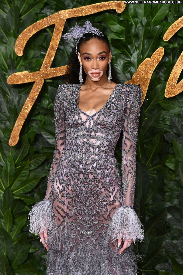 Winnie Harlow No Source  Posing Hot Celebrity Beautiful Sexy Babe